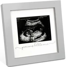 Solo Baby Sonogram Frame (Cloud Gray)